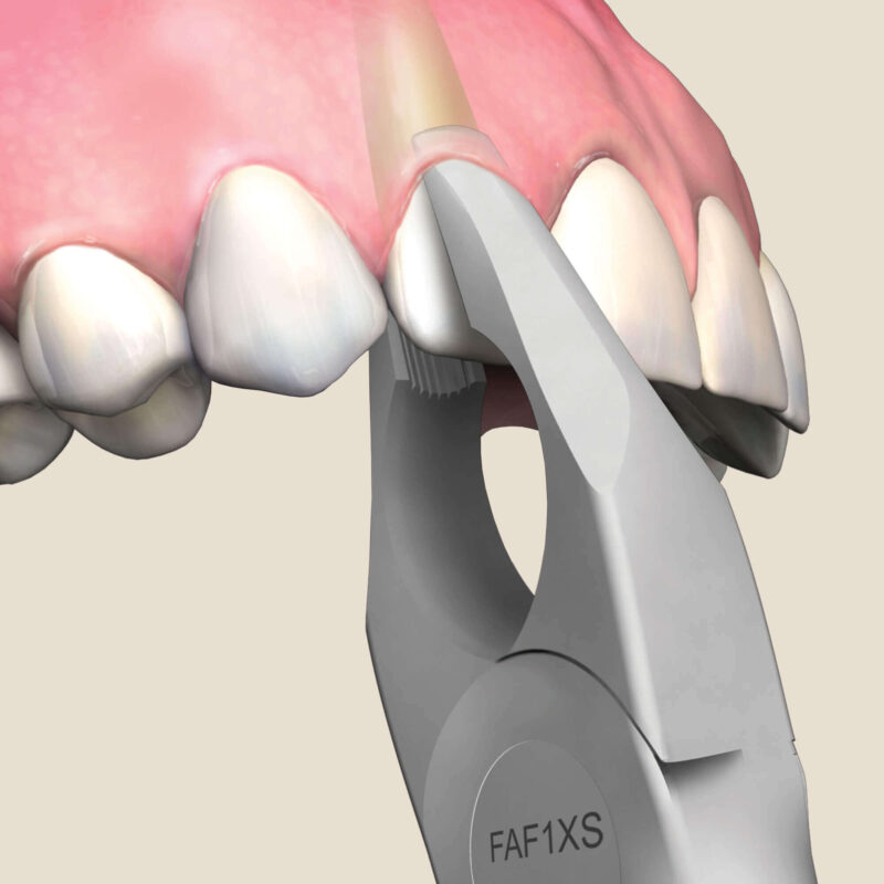 1 Apical Forceps, Upper Incisors, Atraumair